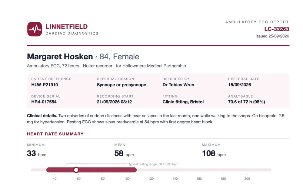 The first page of a 72-hour heart monitoring report, with the heart rate summary.